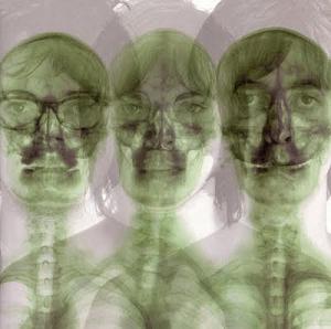 Supergrass